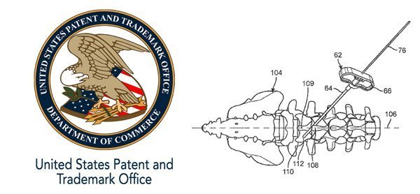 Spinal Facet Bone Screw Patent