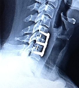 Cavetto Phusion Metal 105